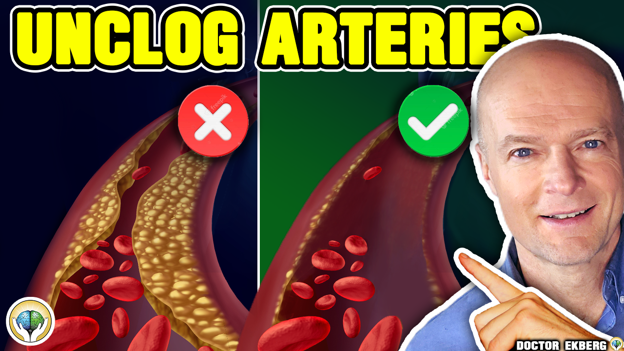 Top 10 Foods To Unclog Arteries Naturally & Prevent Heart Attack